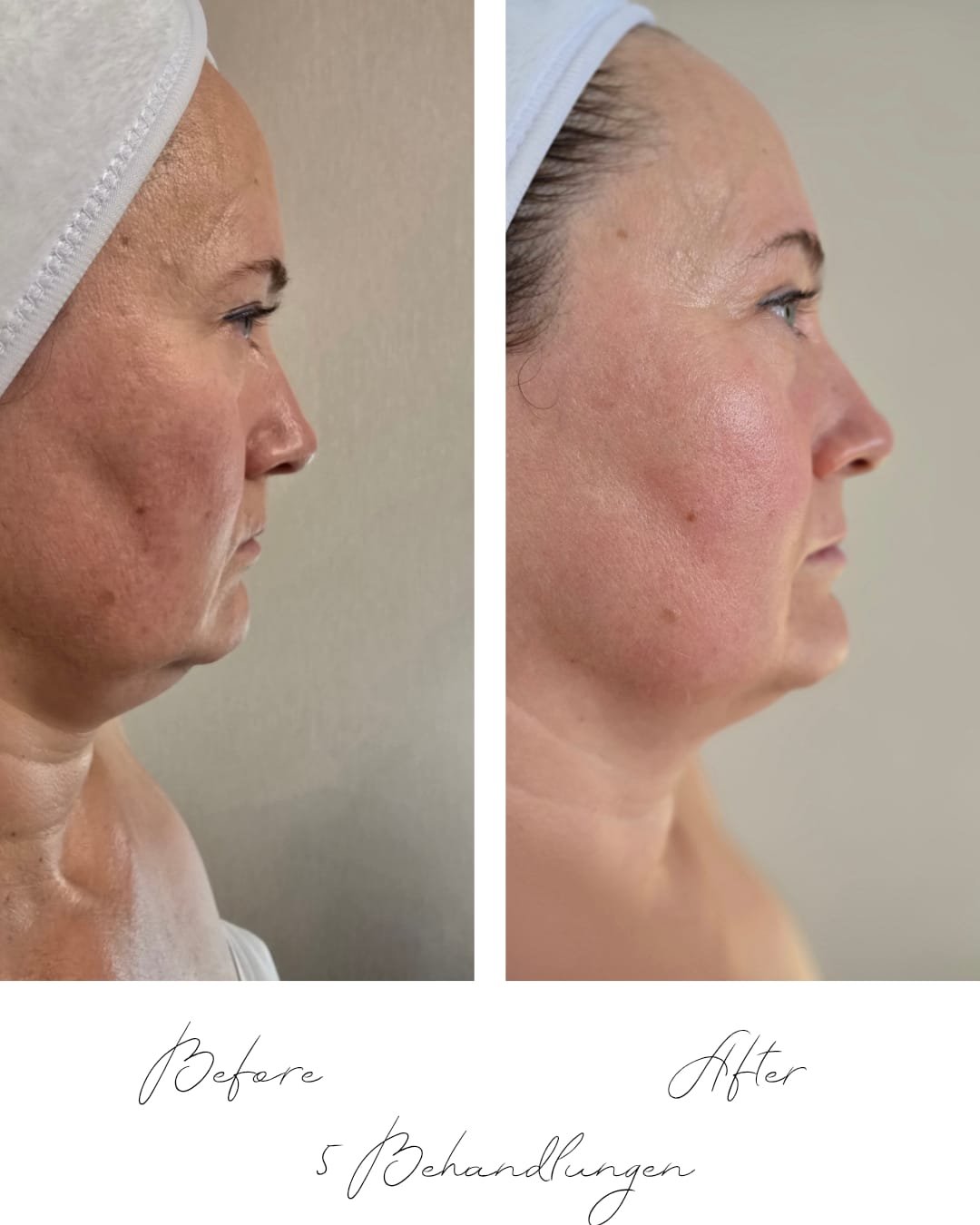 Behandlung 6